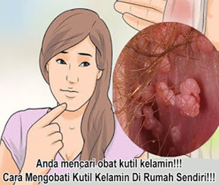 Mengobati kutil kemaluan wanita, mengatasi kutil di alat kelamin, obat kutil kelamin alami dari tumbuhan, obat kutil kelamin bagus, obat kutil kelamin dari dalam, obat kutil kelamin tanpa efek samping, obat tradisional untuk menyembuhkan kutil kelamin, obat kutil kelamin atau kutil di kemaluan di jakarta, cara menghilangkan kutil pada kelamin pria, cara pengobatan kutil kemaluan, kapur sirih untuk obat kutil kelamin